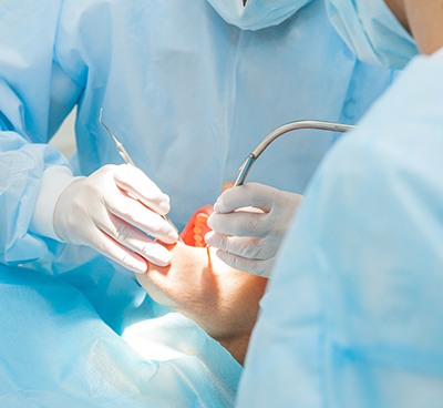 Performing oral surgery for dental implants in Euless, TX