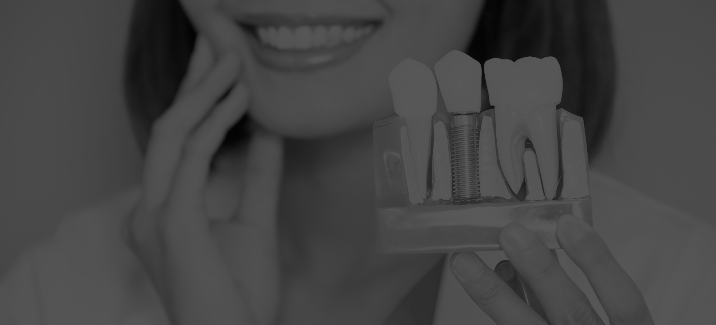 Smiling dentist holding model of dental implant