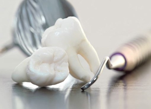 Two extracted teeth next to dental instruments