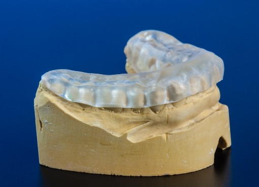 Model of mouth with clear nightguard over the teeth